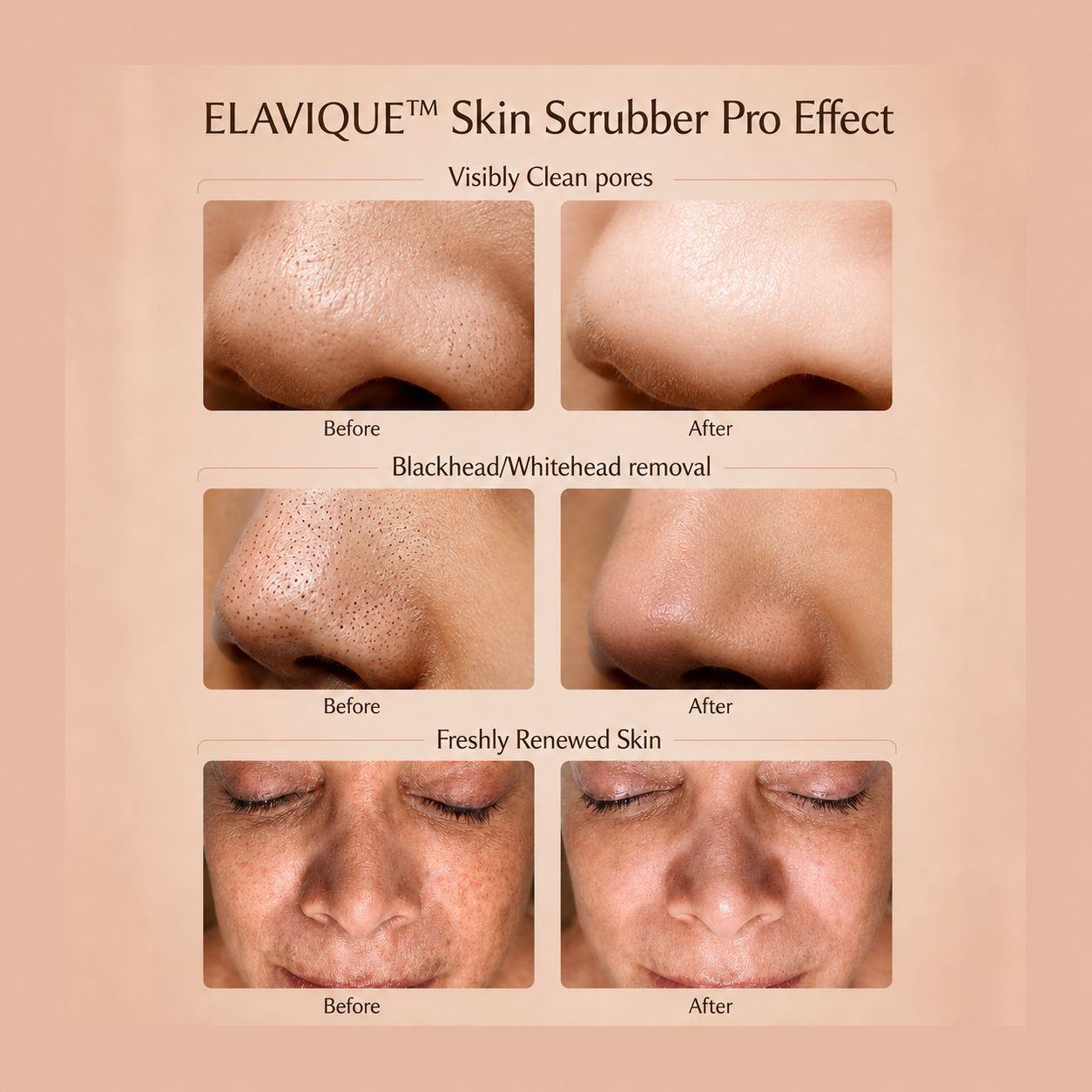 ELAVIQUE™ Skin Scrubber Pro